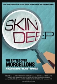 دانلود فیلم Skin Deep: The Battle Over Morgellons 2019 (پوست عمیق: نبرد بر سر مورگولون ها)